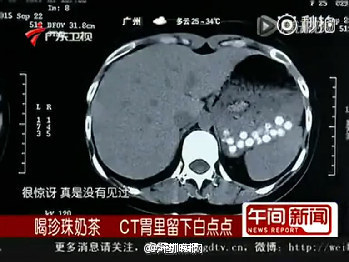 圖片來源:廣東衛視