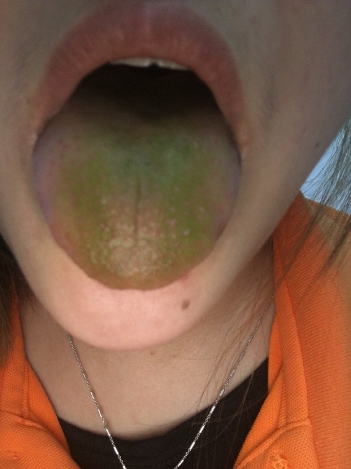 圖片來源:太陽下的一滴水/微博