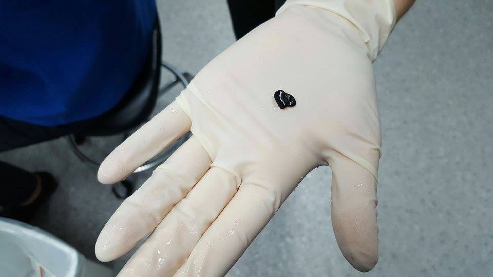 圖片來源：Brisbane Bird and Exotics Veterinary Services