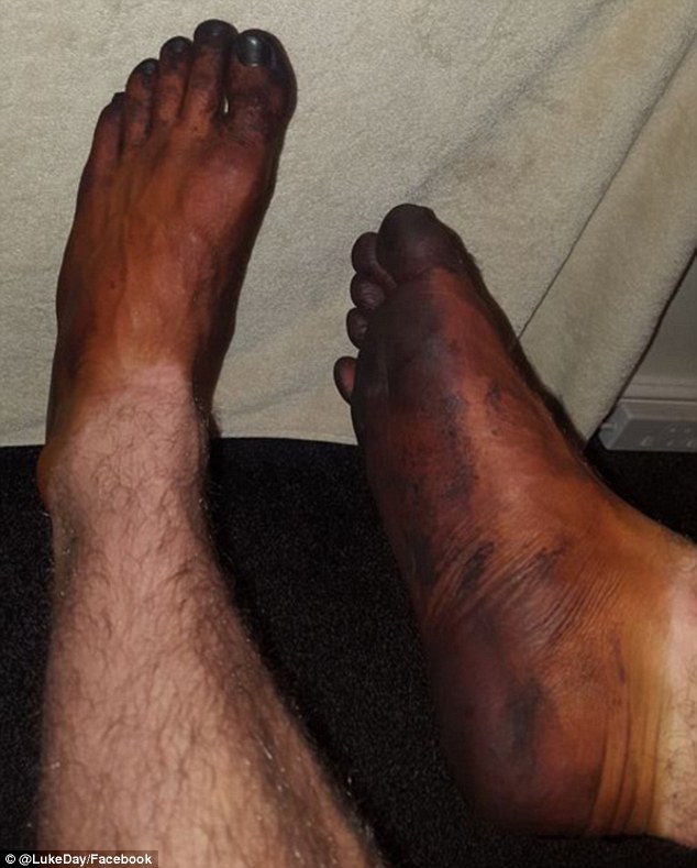 圖片來源：每日郵報