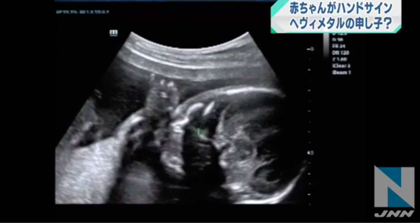 圖片來源:TBS News