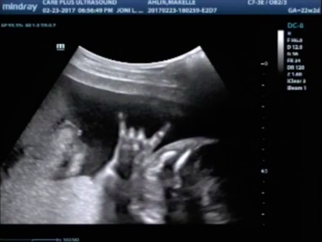 圖片來源:TBS News