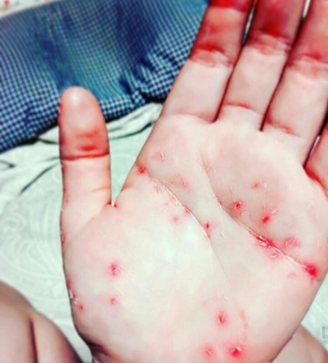 圖片來源：livedoor.jp